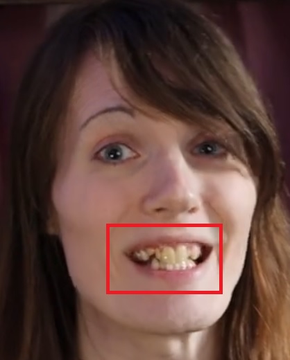 VivianCrookedTeeth.jpg