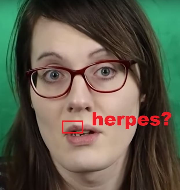 VivianHerpes.jpg